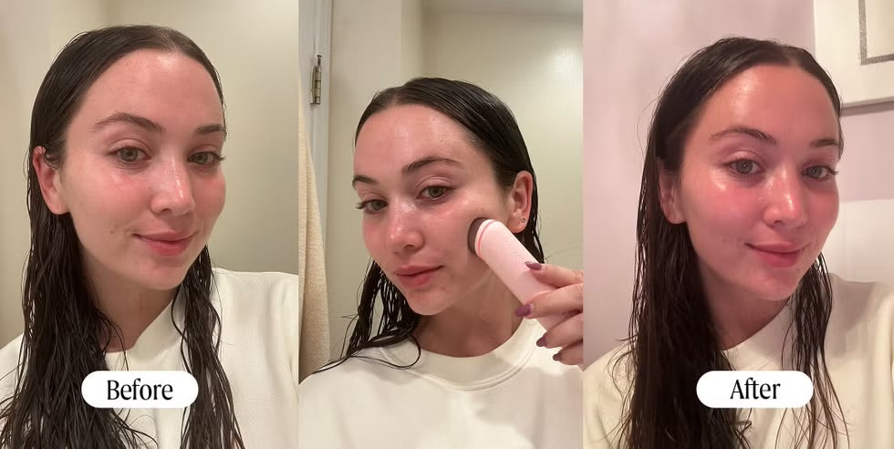 AGE-R BOOSTER PRO | Medicube