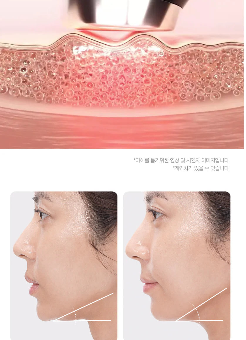 AGE-R BOOSTER PRO | Medicube