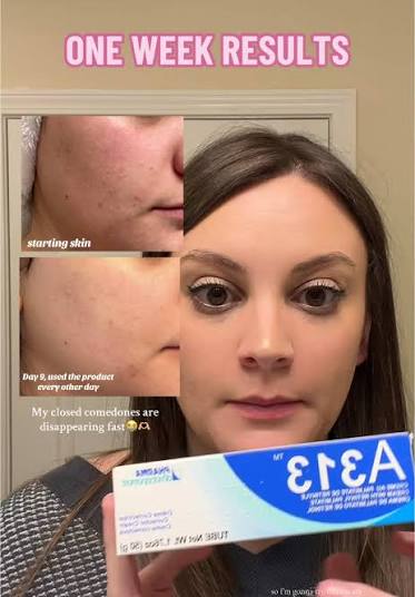 A313 Corrector Cream | Pharma Développement