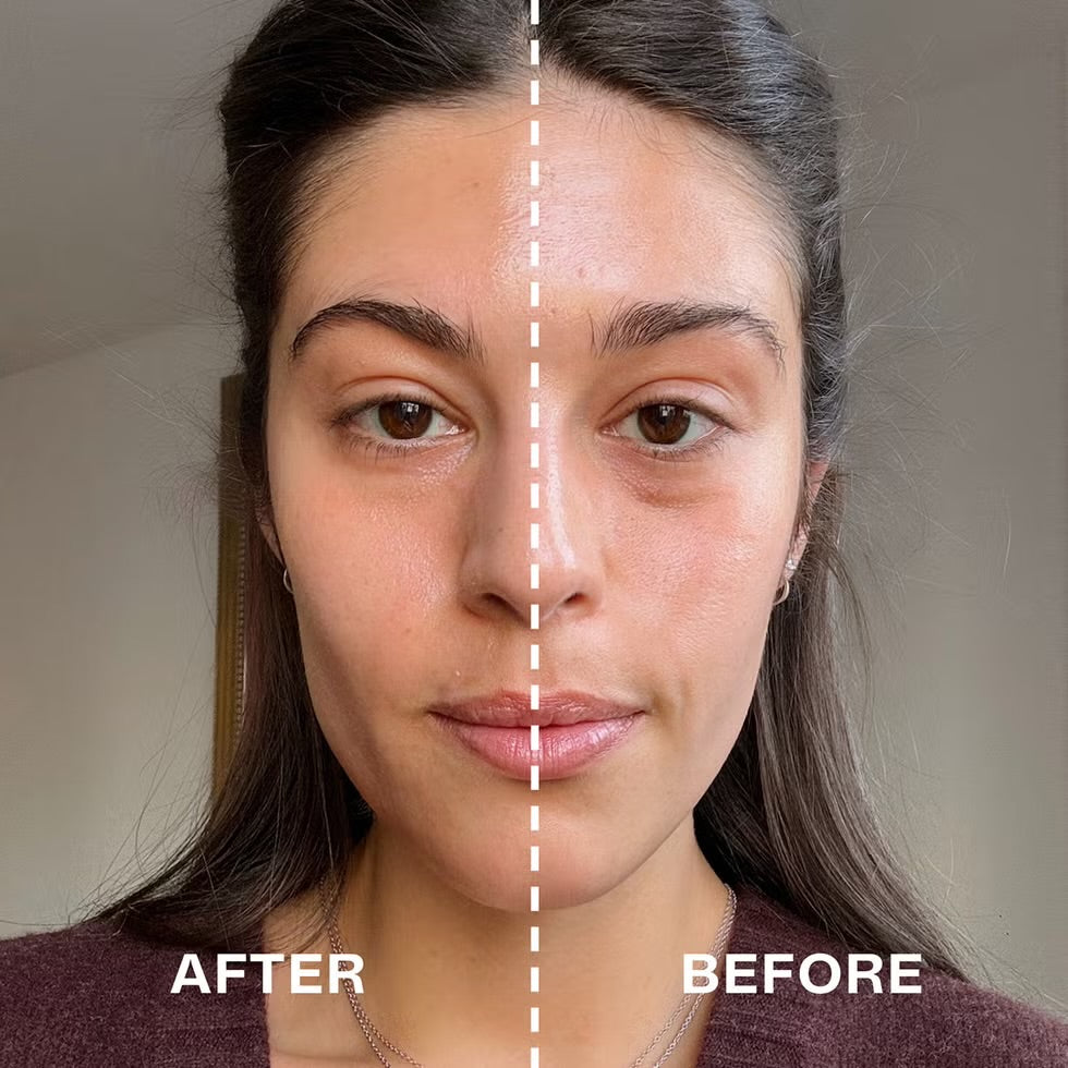 AGE-R BOOSTER PRO | Medicube