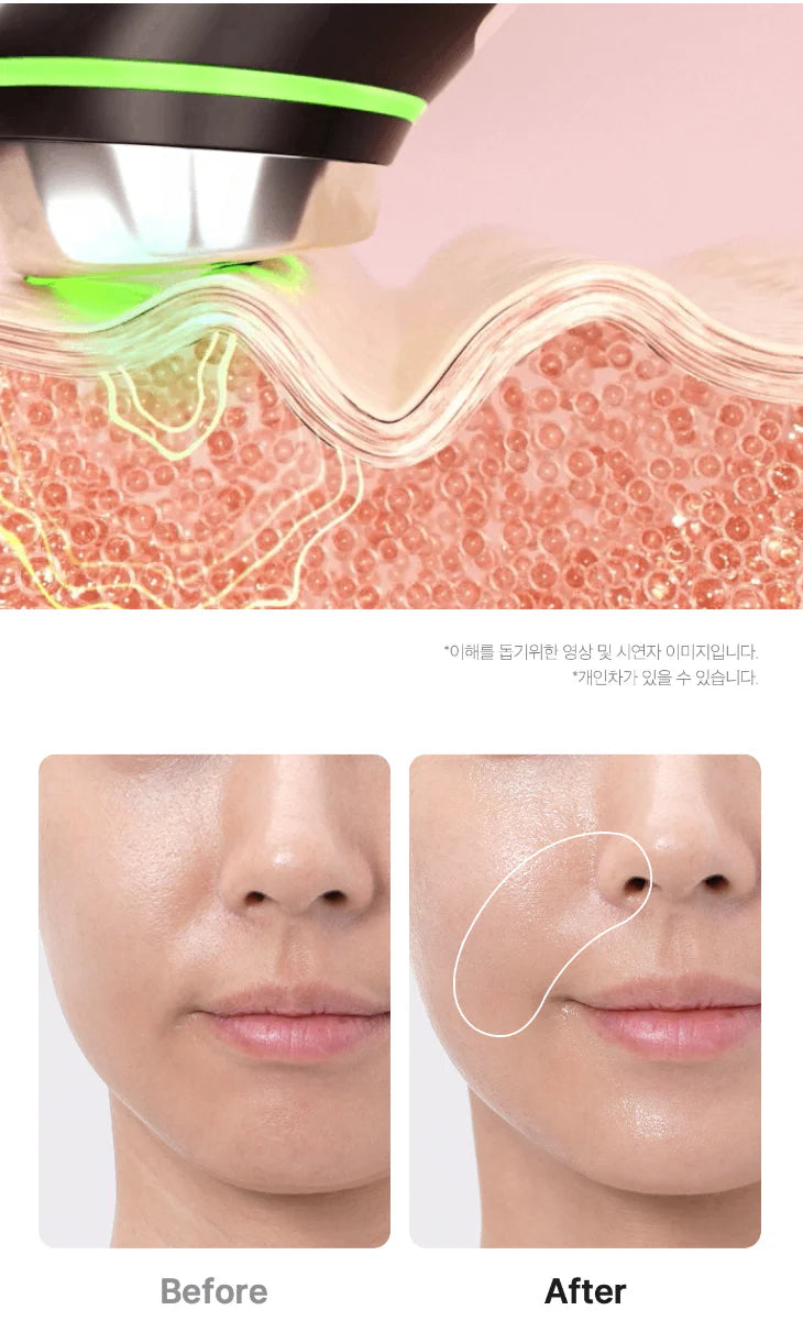 AGE-R BOOSTER PRO | Medicube