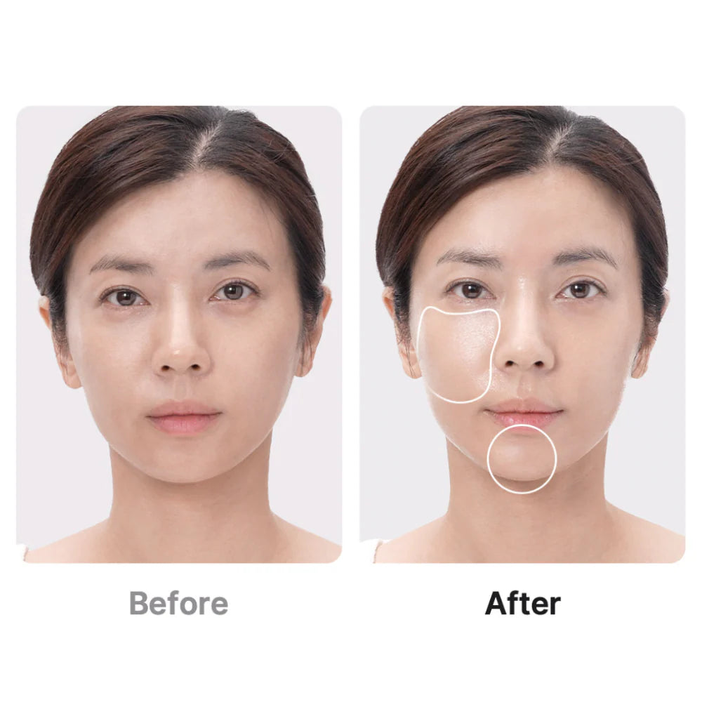 AGE-R BOOSTER PRO | Medicube