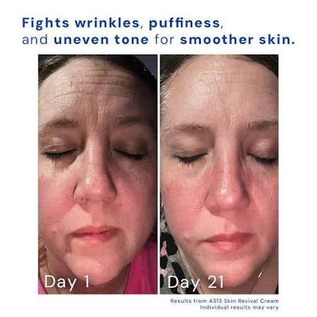 A313 Corrector Cream | Pharma Développement