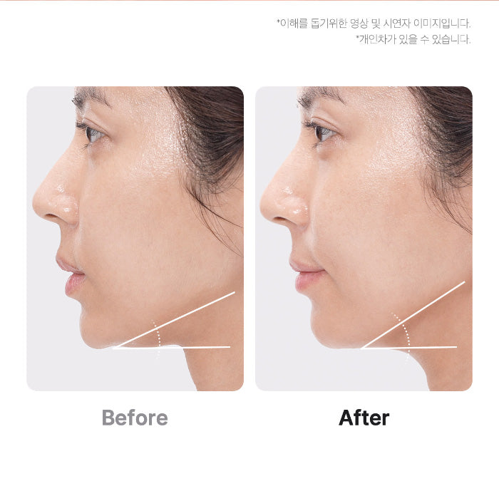 AGE-R BOOSTER PRO | Medicube