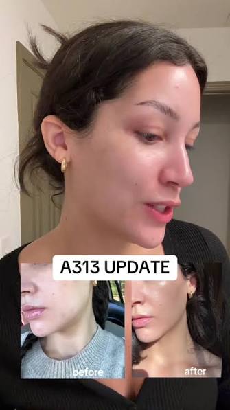 A313 Corrector Cream | Pharma Développement