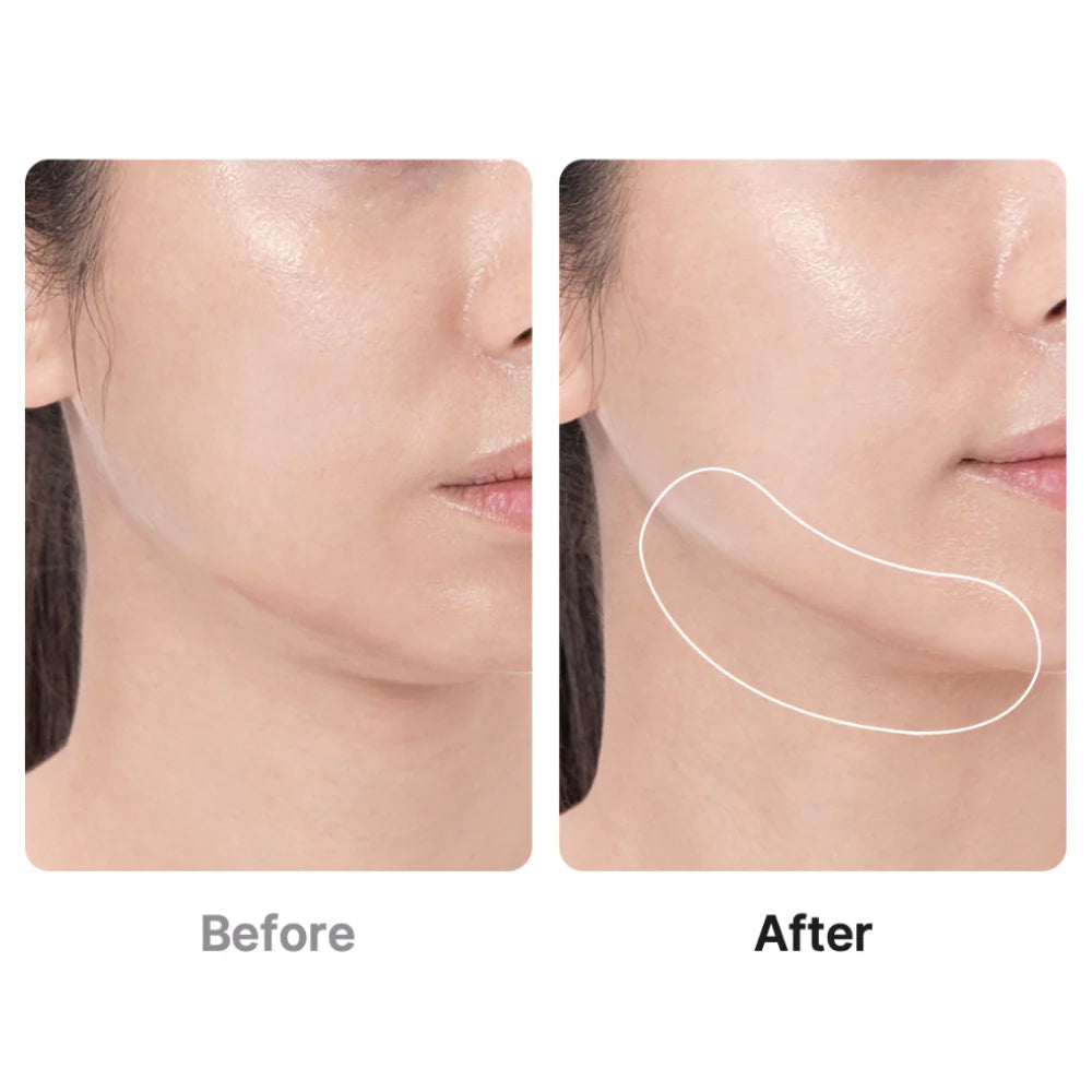 AGE-R BOOSTER PRO | Medicube