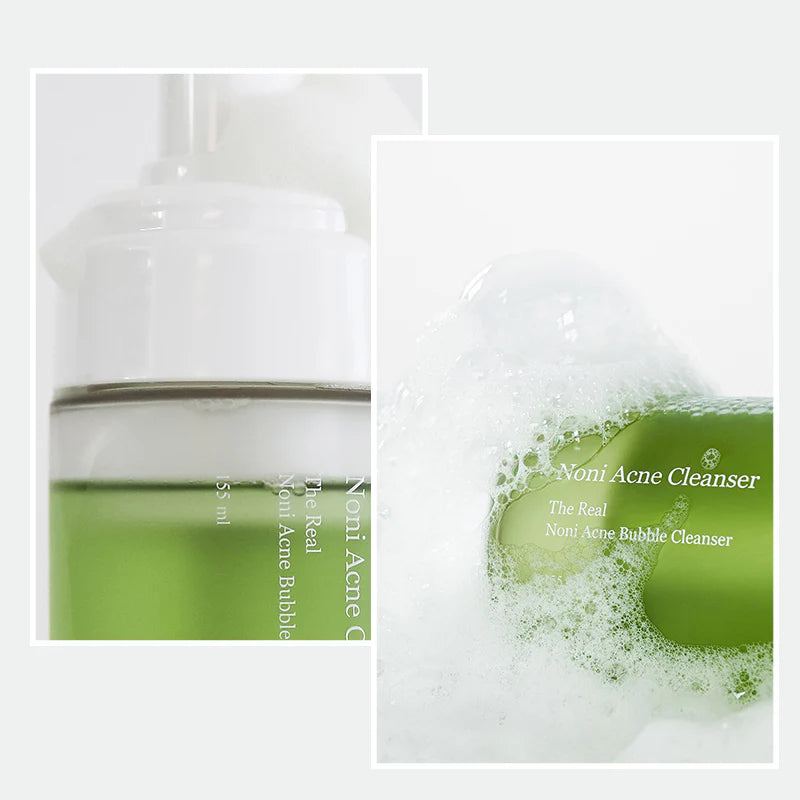 The Real Noni Acne Bubble Cleanser | Celimax