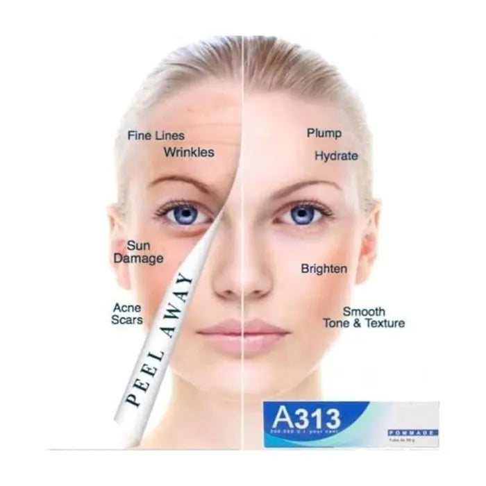 A313 Corrector Cream | Pharma Développement