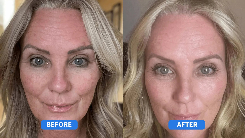 A313 Corrector Cream | Pharma Développement