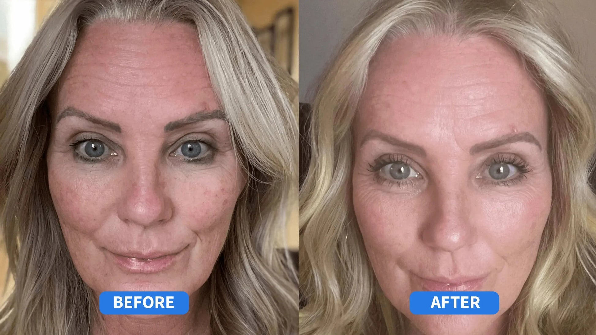 A313 Corrector Cream | Pharma Développement