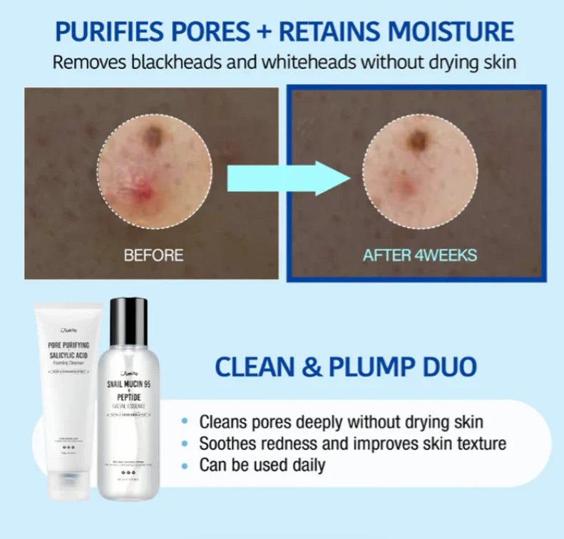 Pore Purifying Salicylic Acid Foaming Cleanser | Jumiso