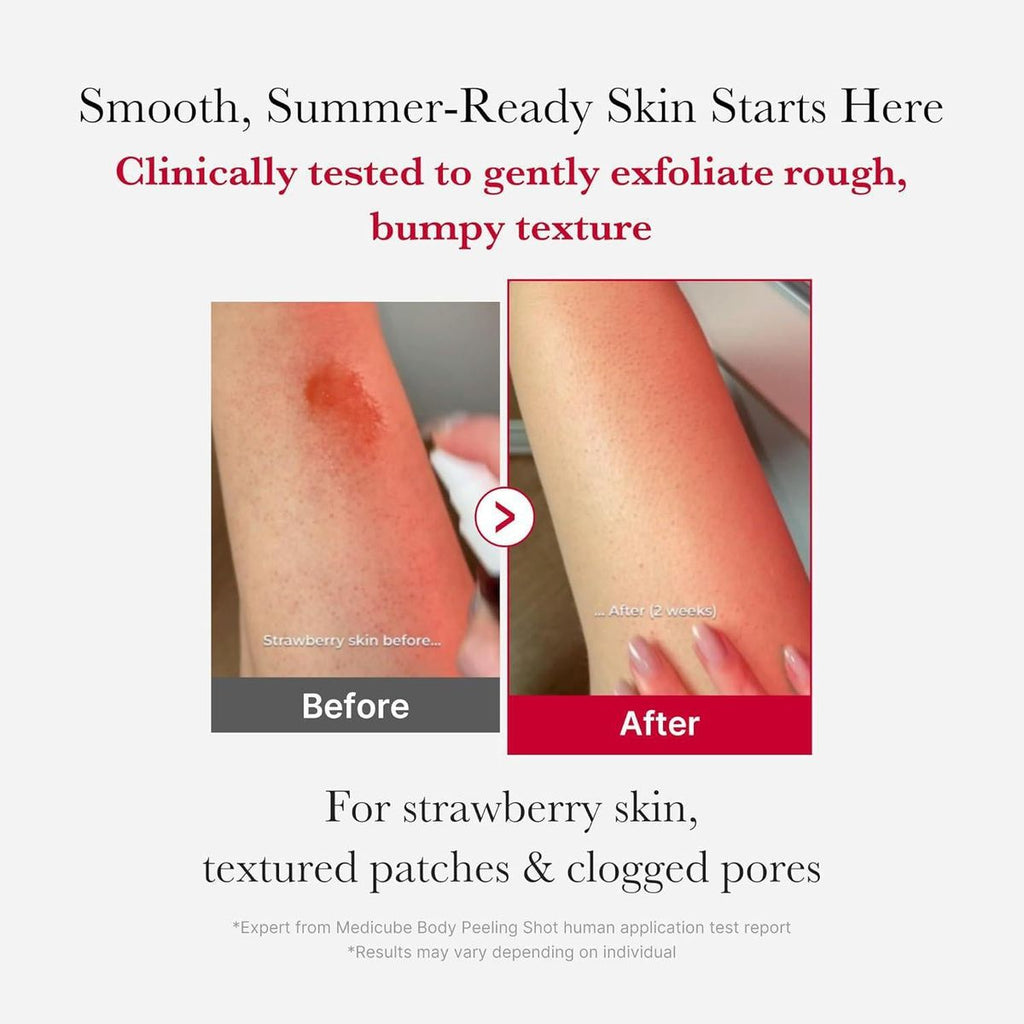 Red Acne Body Peeling Shot | Medicube