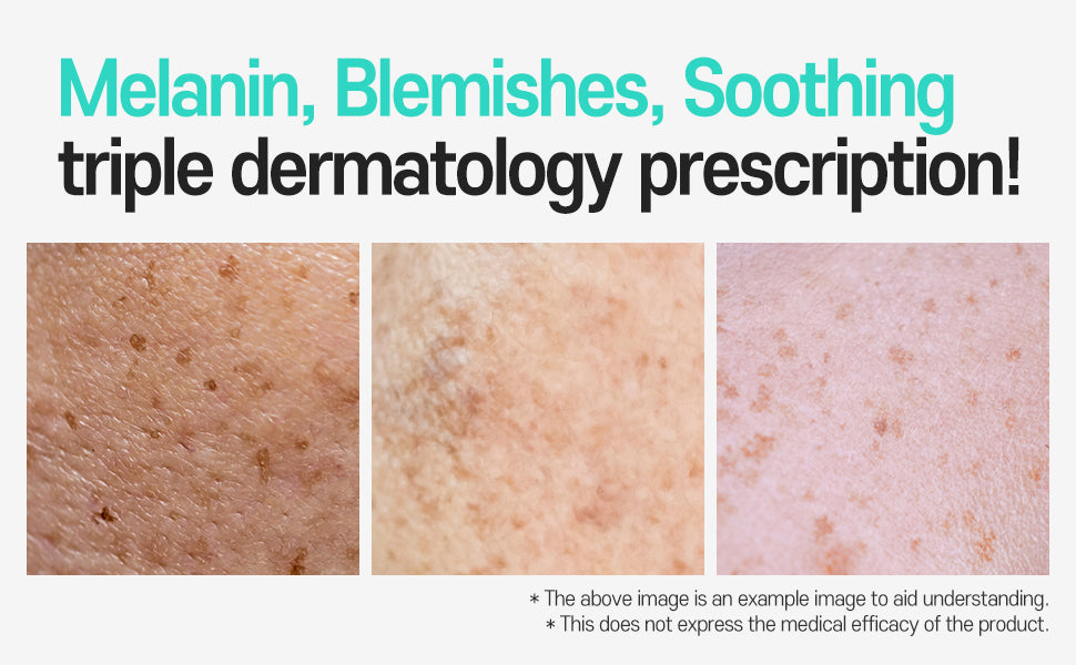 Anti-Melasma Cica Cream | CARE:NEL