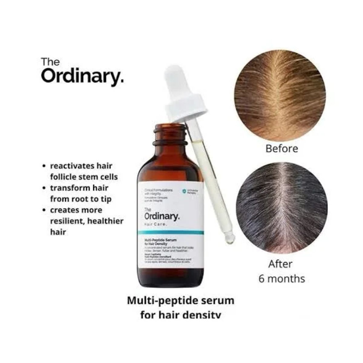 Multi-Peptide Serum for Hair Density | The Ordinaryسيروم تكثيف الشعر