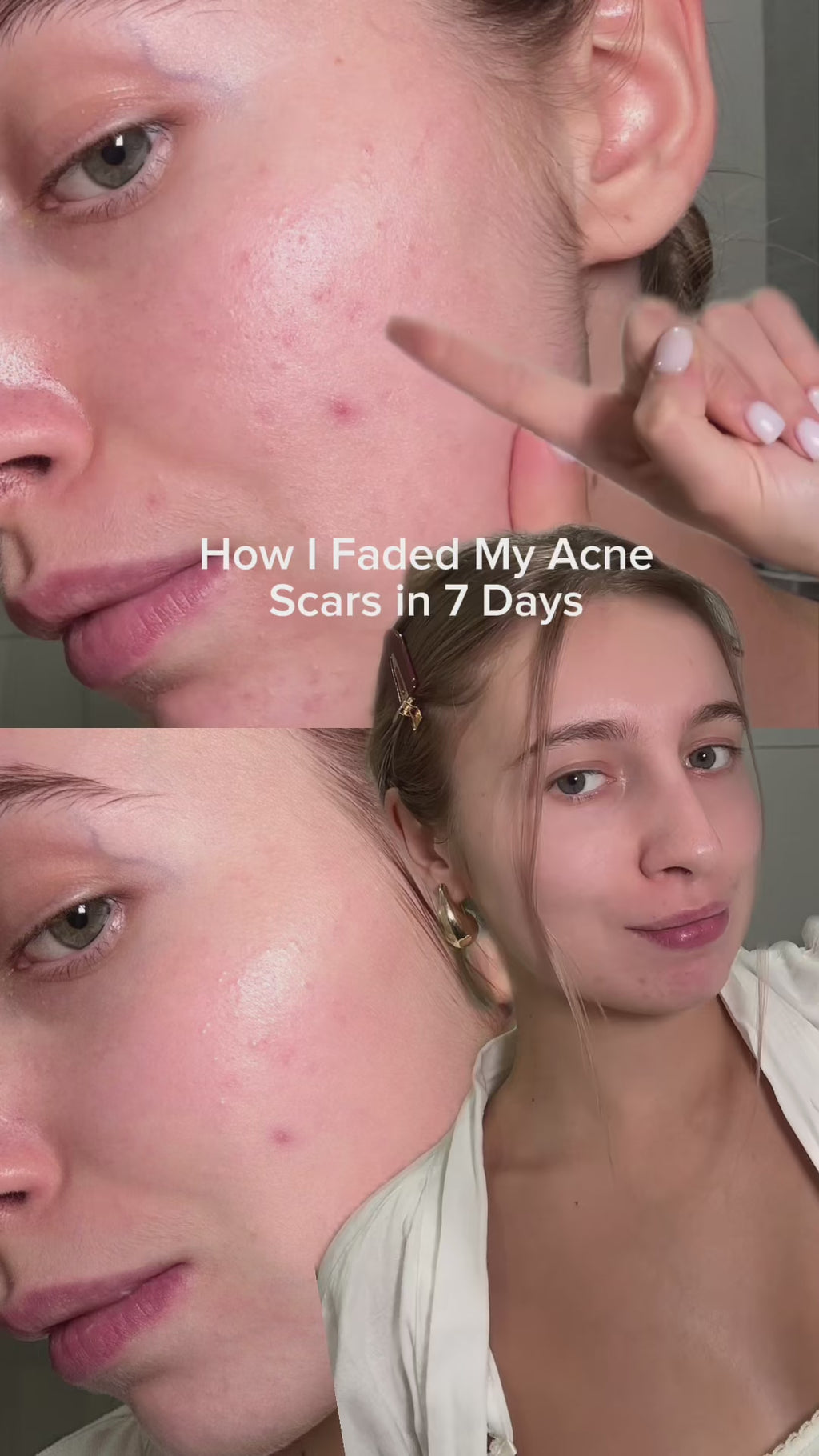 Pink Aloe Mucin Serum | APRILSKIN