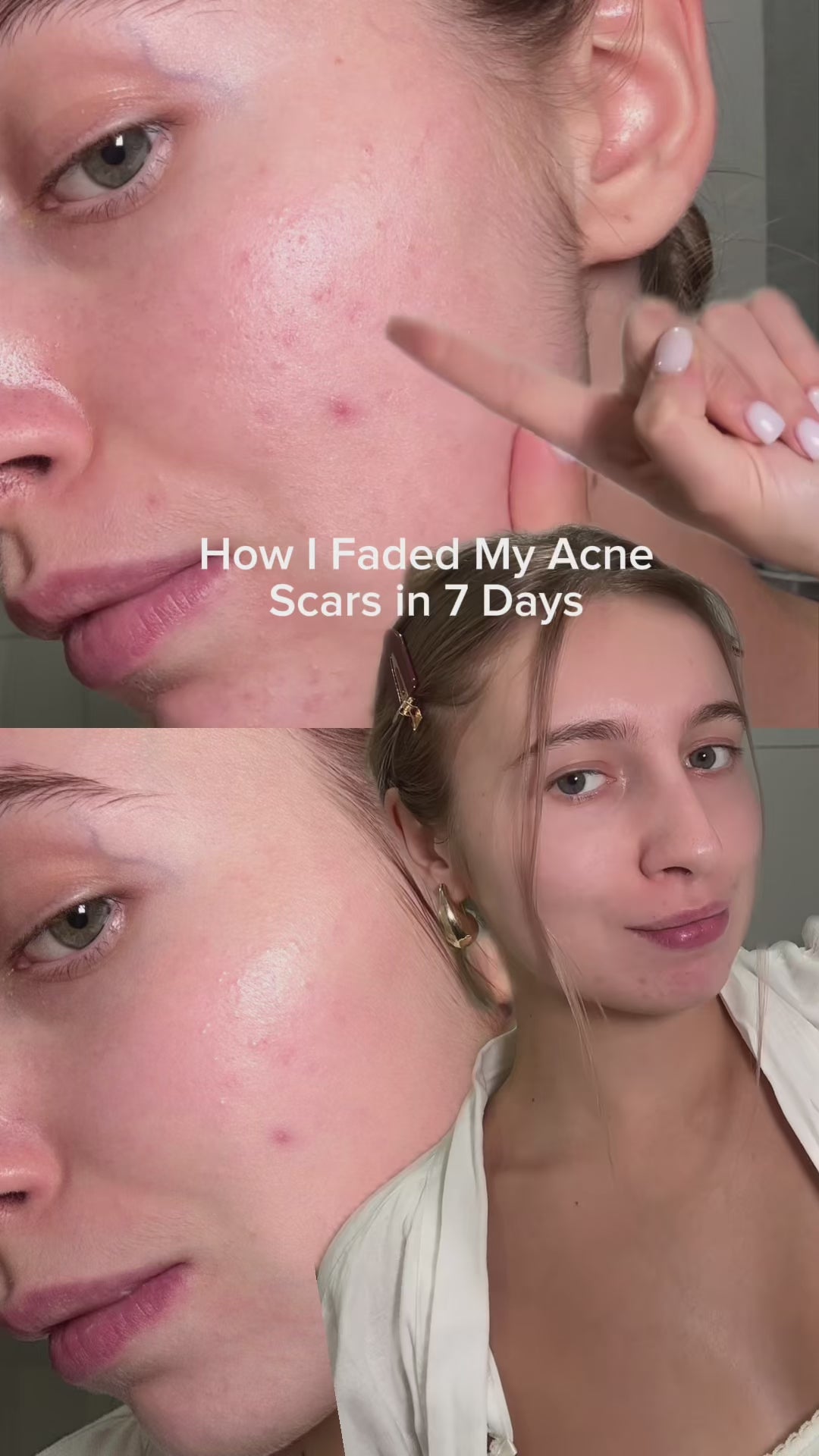 Pink Aloe Mucin Serum | APRILSKIN