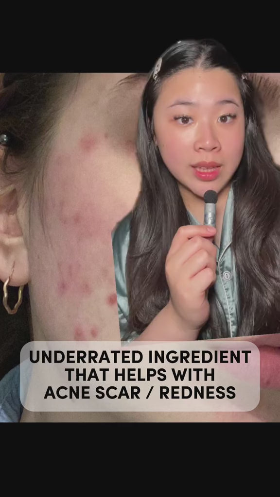 Pink Aloe Mucin Serum | APRILSKIN