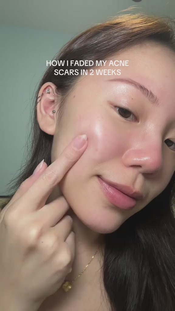 Pink Aloe Mucin Serum | APRILSKIN